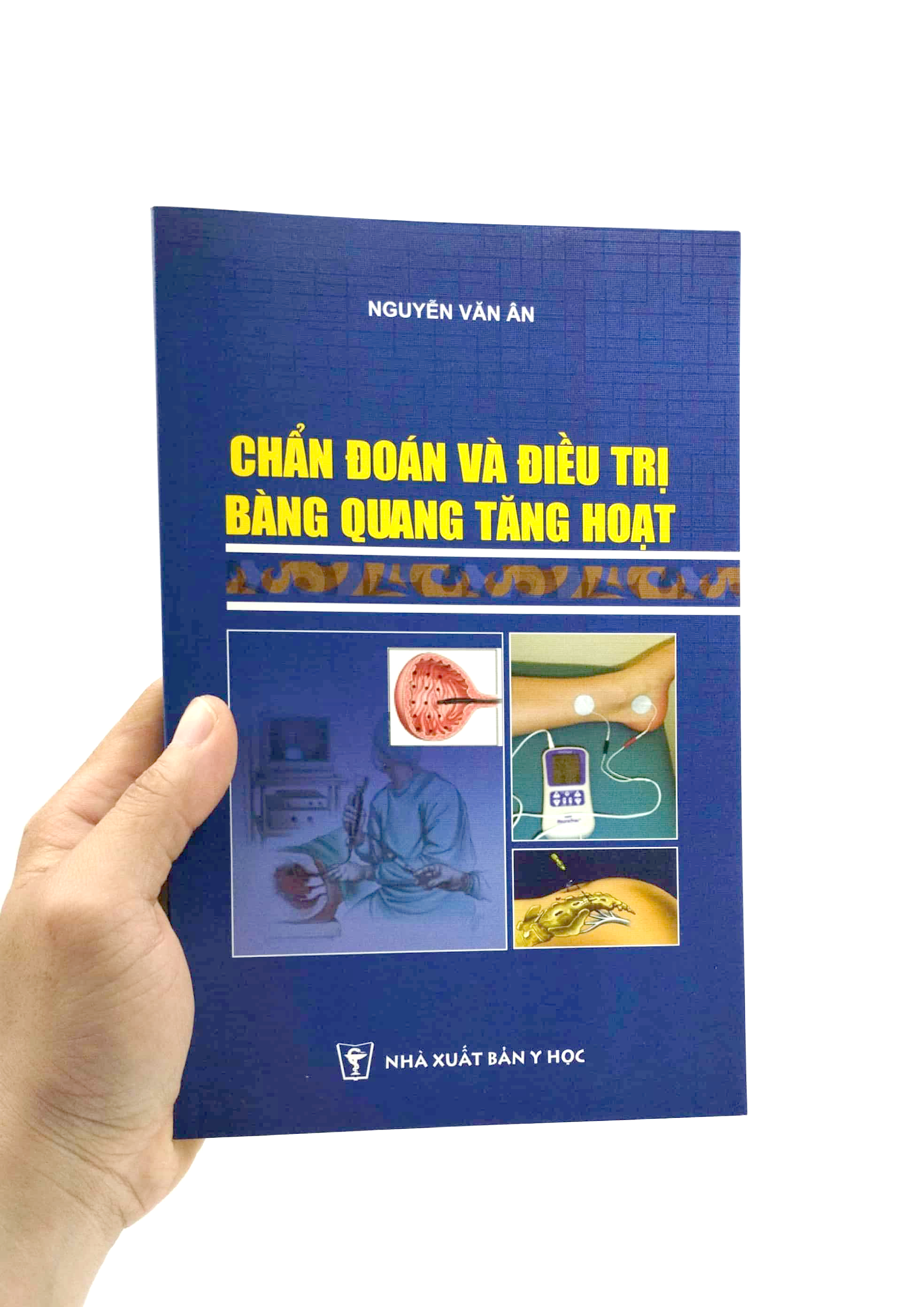Chẩn Đoán Và Điều Trị Bàng Quang Tăng Hoạt PDF